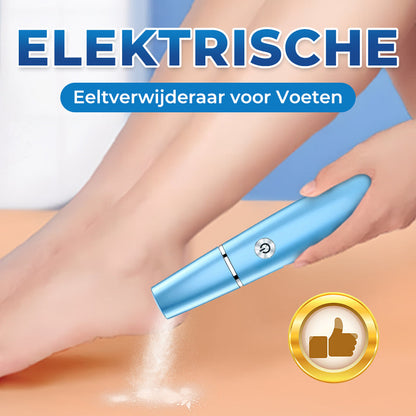 Elektrische Eeltverwijderaar voor Voeten